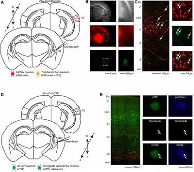 Auditory Long-Range Parvalbumin Cortico-Striatal Neurons